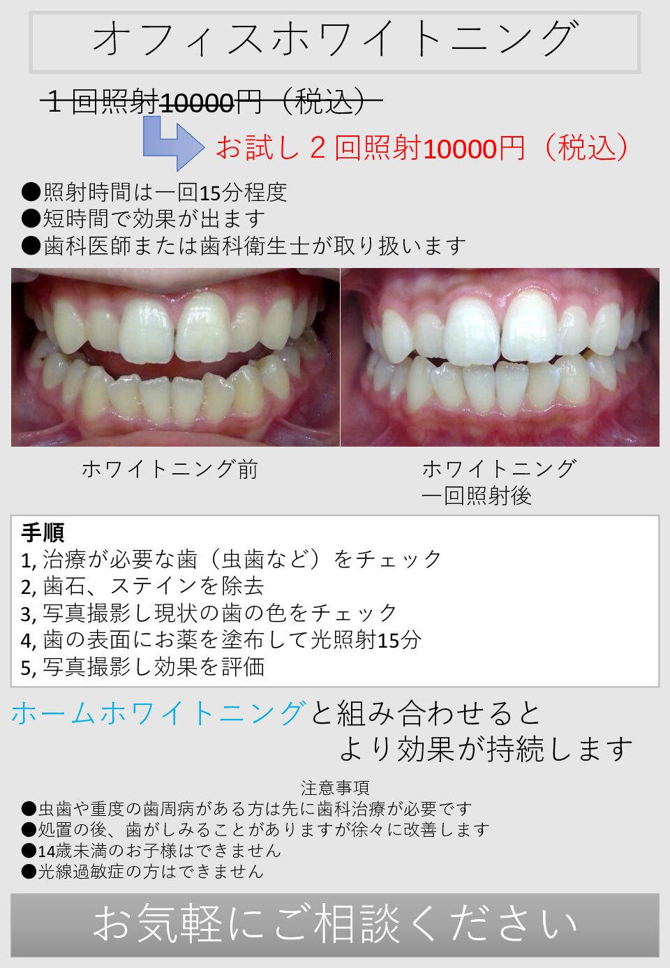 オフィスホワイトニング